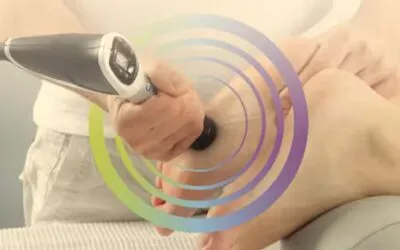 Does Shockwave Therapy Work for Plantar Fasciitis?